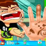 Ben10 Hand Physician – Free On-line Recreation